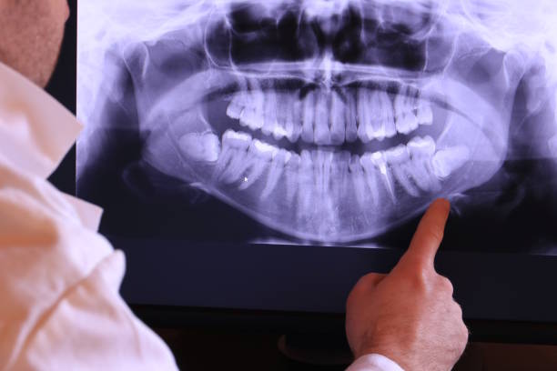 Best Mobile Emergency Dentist in Littleton, CO